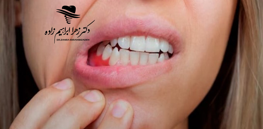 عفونت ایمپلنت