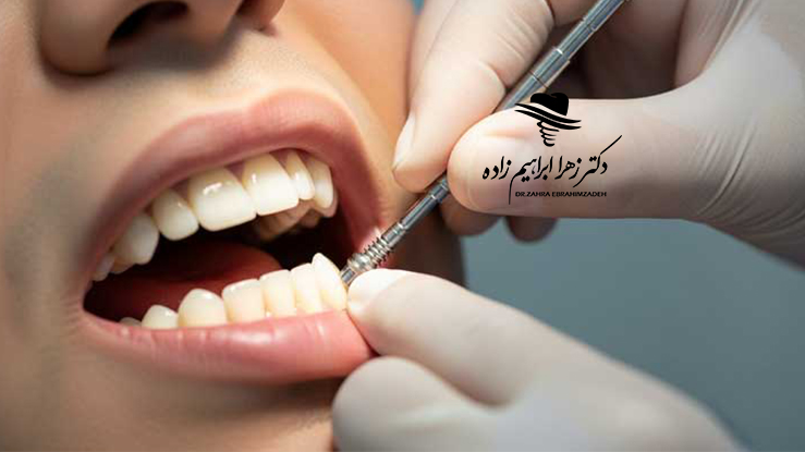 علائم شکست ایمپلنت چیست؟
