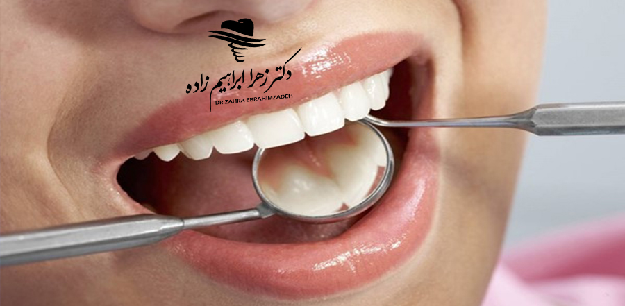 عفونت ایمپلنت