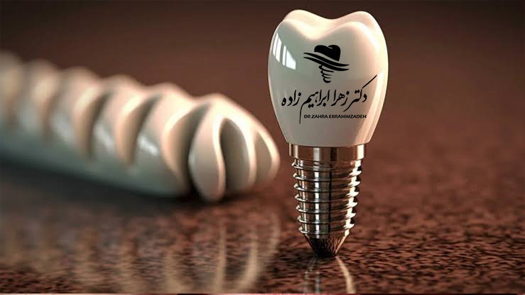 پری‌ایمپلنتایتیس چیست؟