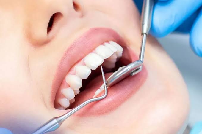 علائم شکست ایمپلنت چیست؟