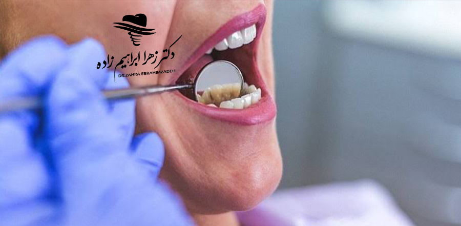 عفونت ایمپلنت