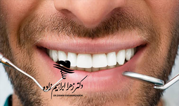 ایمپلنت فوری چیست؟