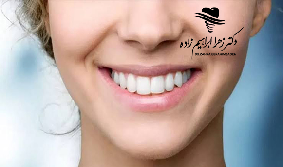 ایمپلنت فوری چیست؟
