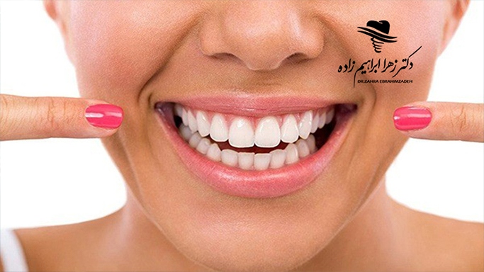 شکست ایمپلنت دندان یعنی چه؟