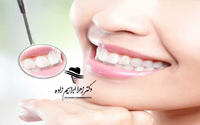 ایمپلنت کل دهان چیست؟